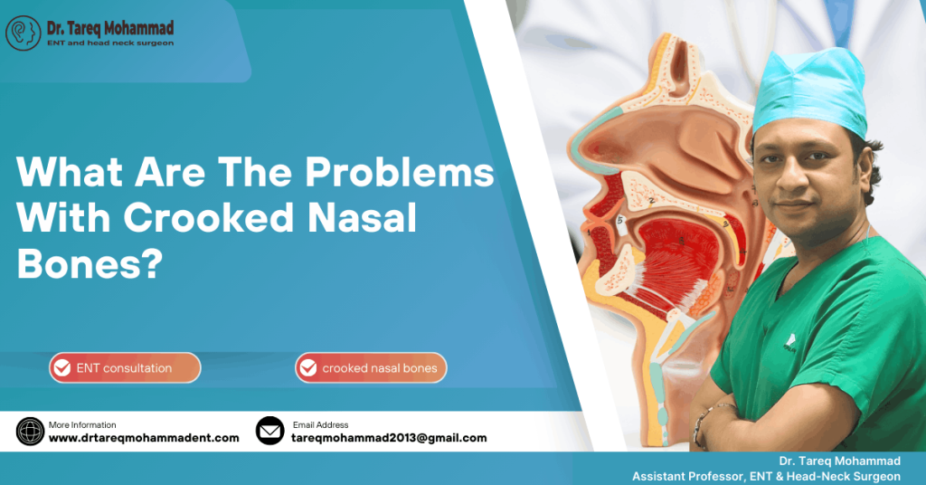 Crooked Nasal Bone Problems | Dr. Tareq Mohammad ENT