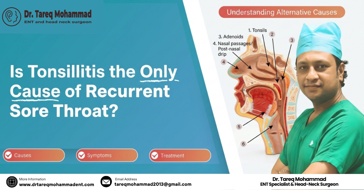 Is Tonsillitis the Only Cause of Recurrent Sore Throat?