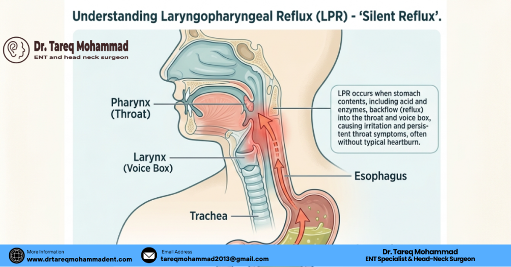 Is Tonsillitis the Only Cause of Recurrent Sore Throat?