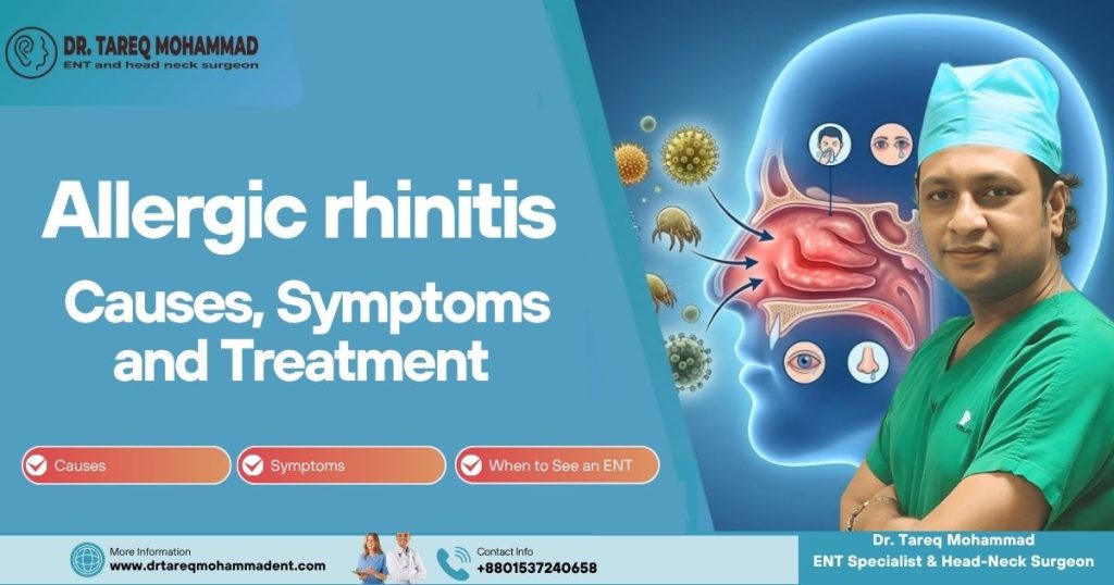 Allergic rhinitis