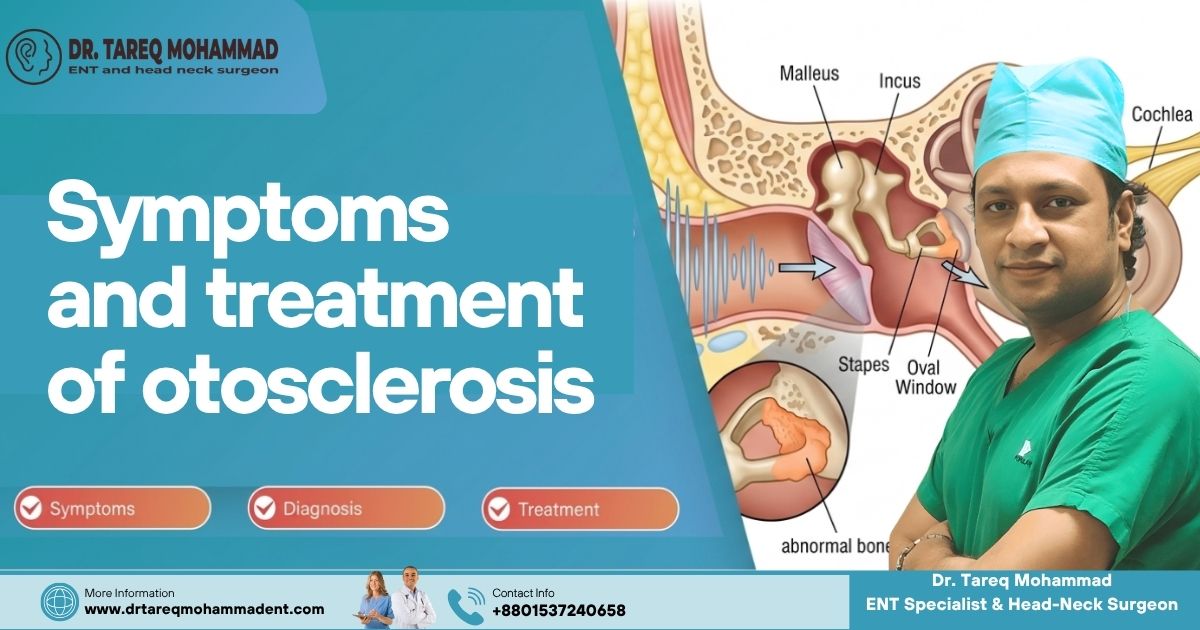 Symptoms and treatment of otosclerosis