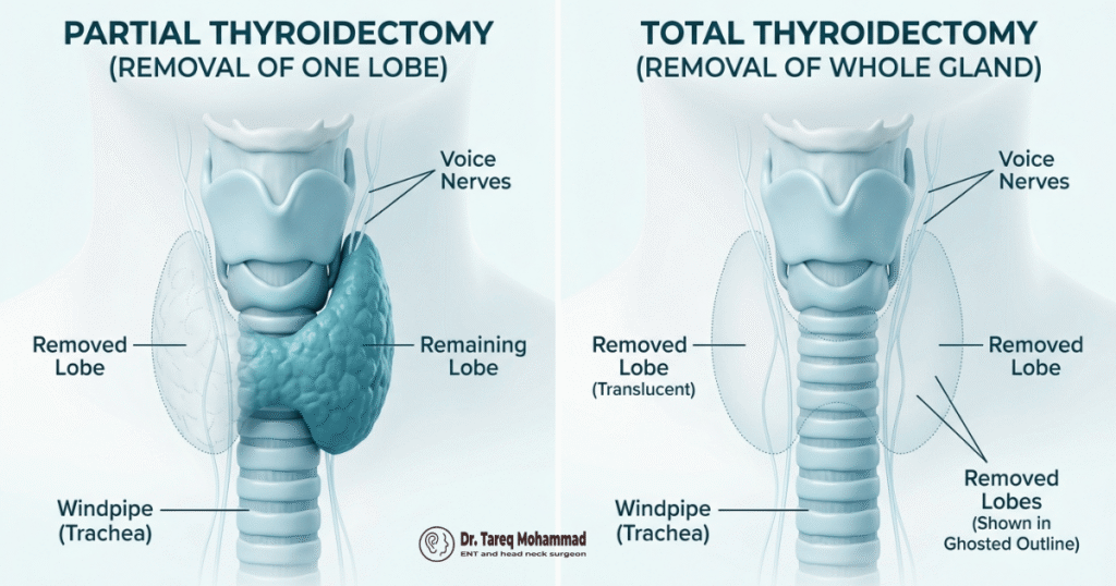 thyroid-lobectomy-vs-total-thyroidectomy
